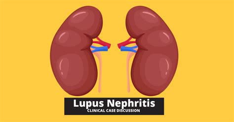 Lupus Nephritis Sle Clinical Case Discussion Tiny Medicine