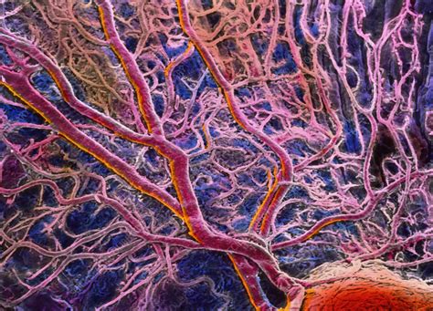 Blood Vessels In Eye Stock Image P4240074 Science Photo Library