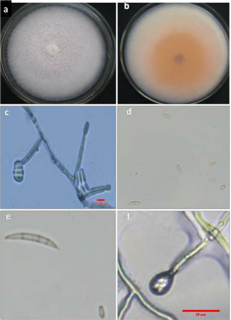 Colony Characteristics Of Fusarium Oxysporum Fsp Sesame Conidiospore