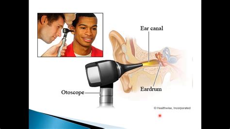 Otoscopic Examination مقدمة في السمع راما ابوالفيلات Youtube