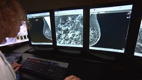What Women Need To Know About Dense Breast Tissue Mammograms And