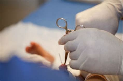 Us Pediatrics Unveil Benefits Of Circumcision Armenian News Tert Am