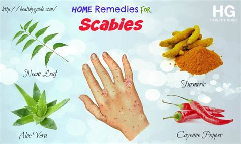 scabies rash treatment home remedies