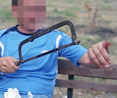 Man Saws Off Two Fingers And Threatens To Cut Off The Others In Russia