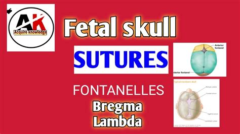 Sutures Of Fetal Skull Sutures Fontanelle Bregma Lambda Most