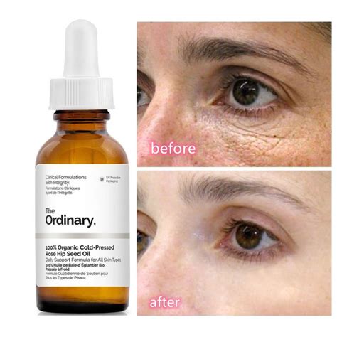 It's free of comedogenic components, gluten, sulfates, fungal acne feeding components, parabens, silicones, polyethylene glycol (peg) and synthetic fragrances. The Ordinary Caffeine Solution 5% + EGCG - Fatiexpress