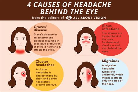 Headache Behind Eyes Sensitive To Light