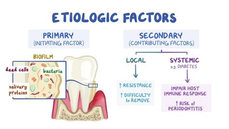 Risk Factors For Periodontitis Video Anatomy Osmosis