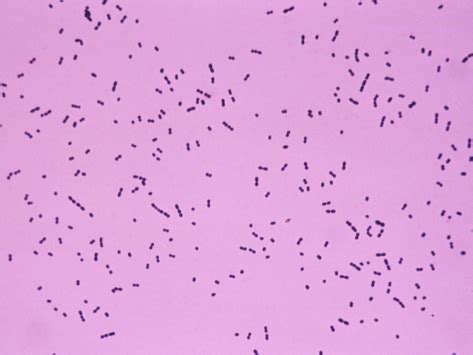 Streptococcus Pneumoniae Stepwards