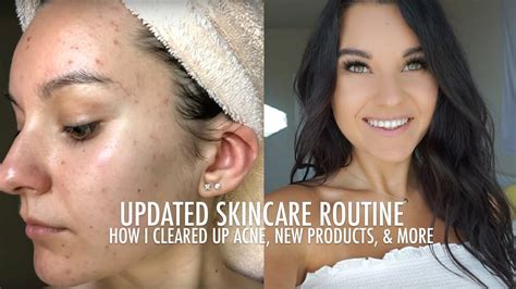 Updated Skincare Routine How I Cleared Up My Acne Youtube