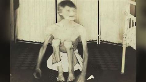 Rare Photos Taken From Old Insane Asylums Show Their Harsh Conditions