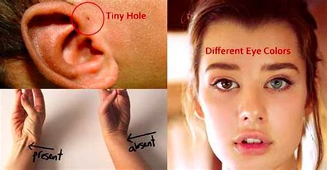 5 Very Rare And Fascinating Body Features Of Humans Do You Have Any