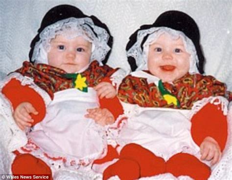 Identical Twins With Illness So Rare It Was Named After Them Can