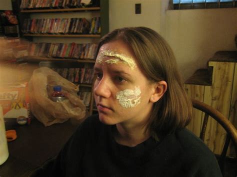 Jen Transformation 4 Nasty Facial Wound More Icky Peelin Flickr
