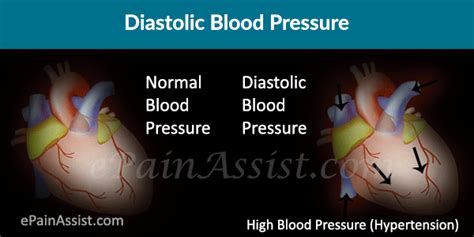 Low blood pressure might seem desirable, and for some people, it causes no problems. What Does High or Low Diastolic Blood Pressure Indicate?
