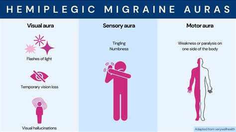 Familial Hemiplegic Migraine 2023 Study Identifies 2 New Genes