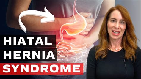 Hiatal Hernia Syndrome Youtube