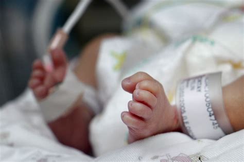 The Impact Of Prematurity In Twins And Multiples