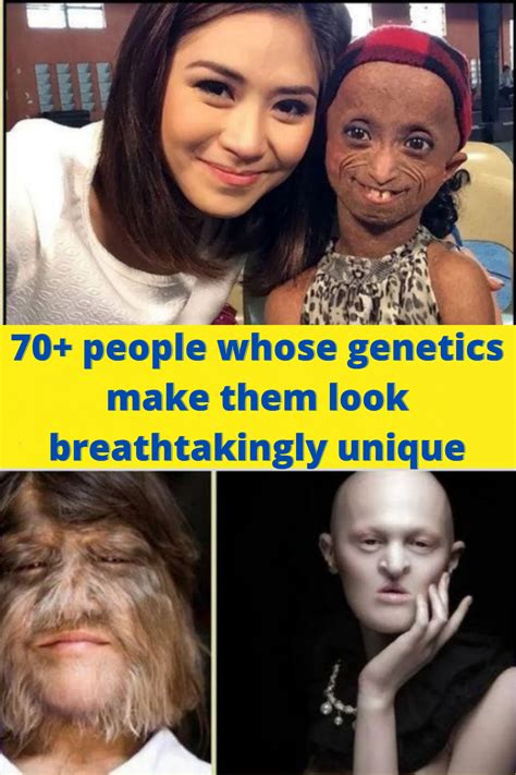 70 People Whose Genetics Make Them Look Breathtakingly Unique Top 10