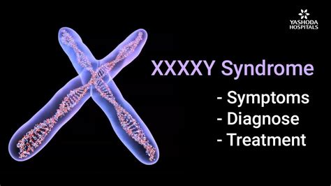 xxxxy syndrome symptoms diagnosis and treatment