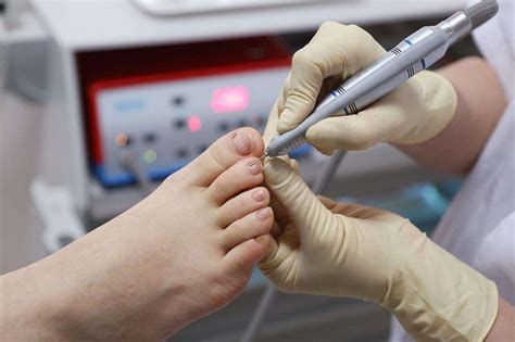 Planning To Visit A Podiatrist Heres All You Need To Know