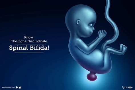 Know The Signs That Indicate Spinal Bifida By Dr Shailesh Jain