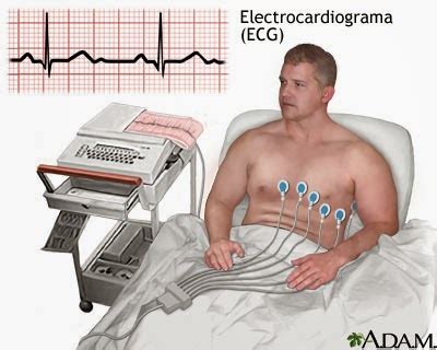 Bioinstrumentacion Electrocardiograma