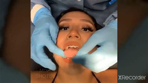 She Sucked The Dentists Finger😲 Youtube