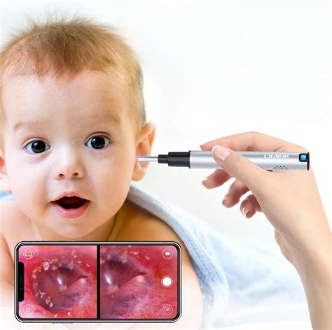 Best Digital Otoscope For Phone In 2022