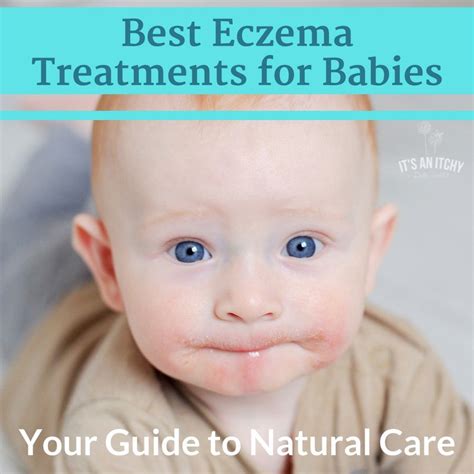 When looking for an eczema friendly cream, there are a few things that are important to consider so i spoke dr emma wedgeworth, a consultant dermatologist & british skin foundation spokesperson who i knew would be an independent voice that could provide. Best Eczema Treatments for Babies: Your Guide to Natural ...