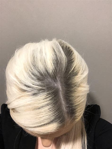 Hair Help Been Bleaching Hair For Over A Year And Want To Stop