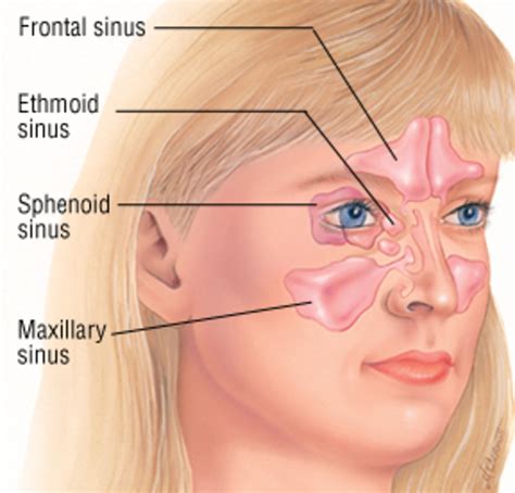 Sinusitis A Very Lowering And Painful Infection Hubpages