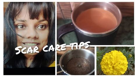 Evening Chae With Me I Scar Care Tips I Post Thyroidectomy