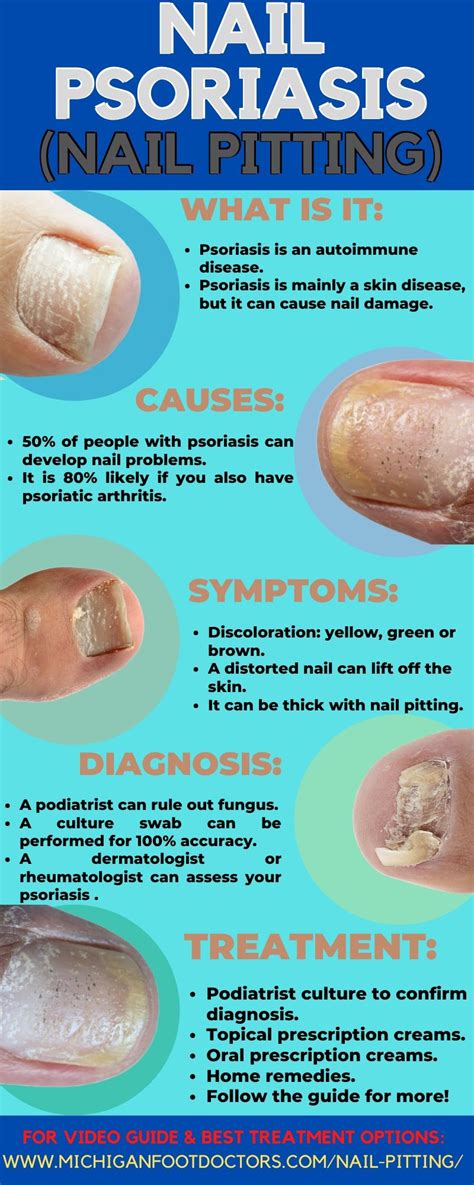 Psoriasis Of The Feet Treatment Causes Symptoms And Best Treatment