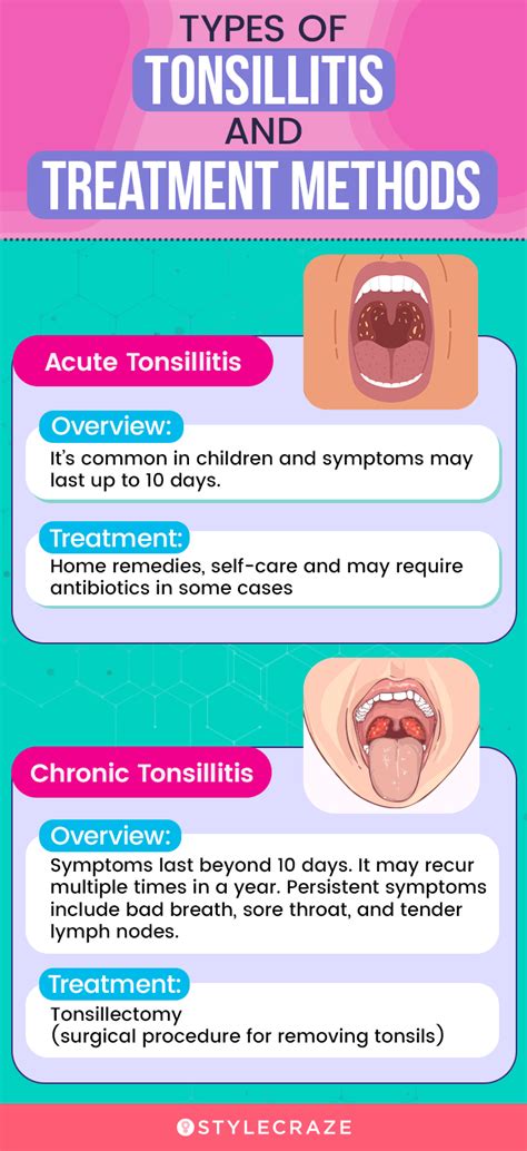 Tonsils Treatment At Home