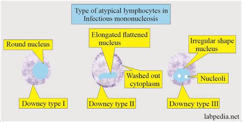 Epstein Barr Virus Ebv And Infectious Mononucleosis