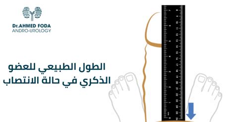 الطول الطبيعي للعضو الذكري في حالة الانتصاب دكتور أحمد فودة