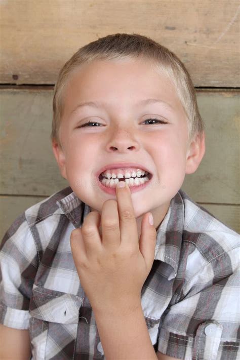 5 Portrait Boy Missing Tooth Free Stock Photos Stockfreeimages