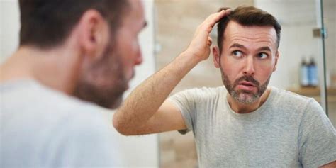 5 Early Signs Of Balding What To Do Next Innovations Medical