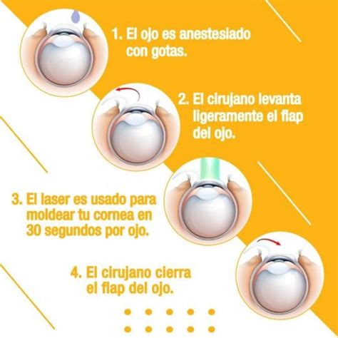 Las Ventajas De Una Cirugía Ocular Con Láser O Lasik Centro Ocular De