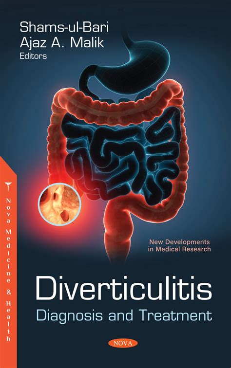 Diverticulitis Diagnosis And Treatment Nova Science Publishers
