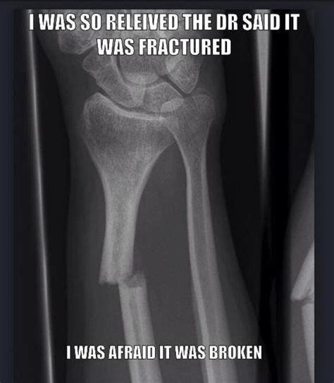 Oh Its Just A Fracture Radiology Humor Xray Humor Xray Tech Humor