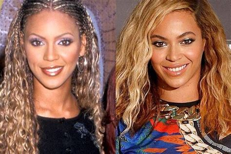 Beyonce Before And After Plastic Surgery Including Nose Job And Lips