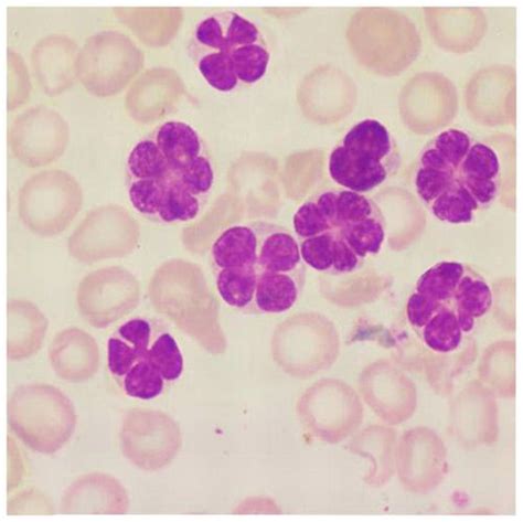 Adult T Cell Leukemia V Purple Verbena The Image Above Shows A Number