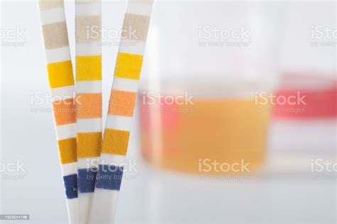 Urine Test Strip Against A Urine Sample On A White Background Stock