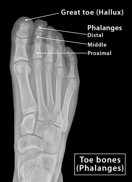 Toe Bones Phalanges Of The Foot Anatomy Location And Diagram