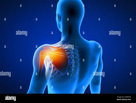 Shoulder Pain Xray Hi Res Stock Photography And Images Alamy