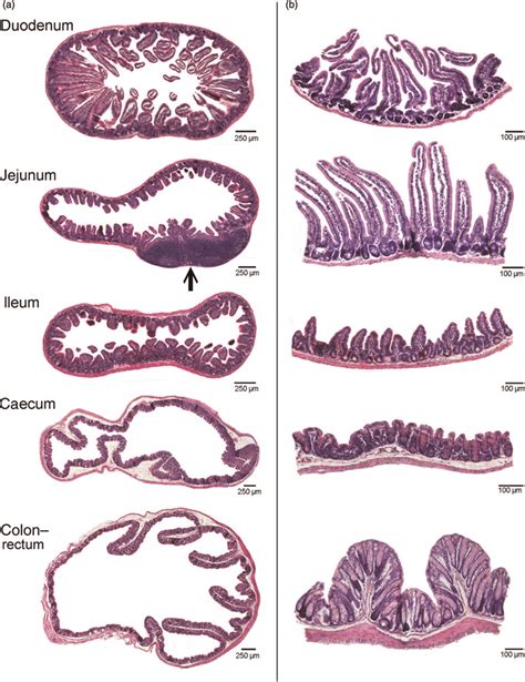Histological Sections Of The Various Transversely Cut Intestinal