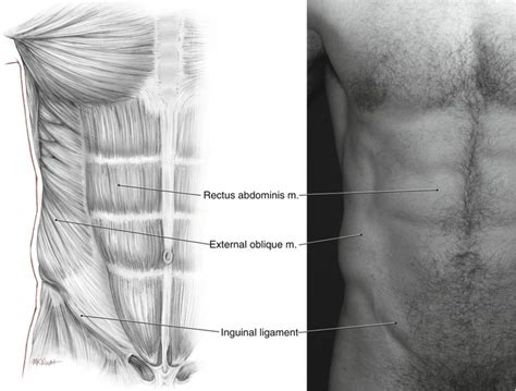 The abdominal divisions should be used in conjunction with other diagnostic approaches in order to accurately diagnose a patient's condition. Muscular and Surface Anatomy | Plastic Surgery Key