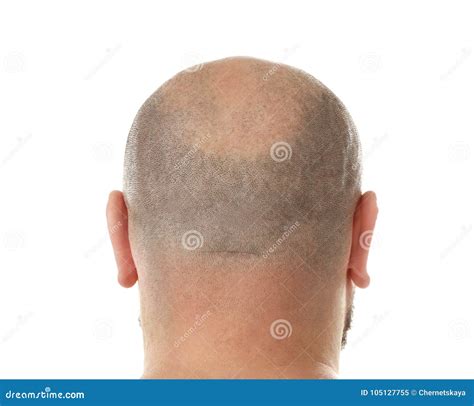 Bald Adult Man Stock Image Image Of Haircare Adult 105127755